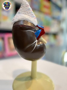 نموذج تشريحي لبنية الكلى البشرية