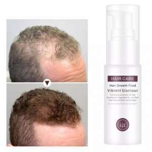 سائل لمنع تساقط الشعر وزياده نموه hair growth fluid hair care vibrant glamour